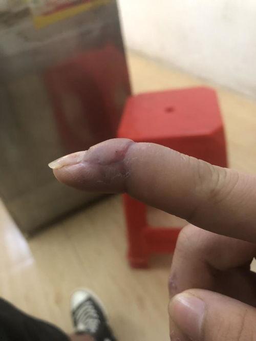 手指缝针图片,探索手指缝针的神奇魅力