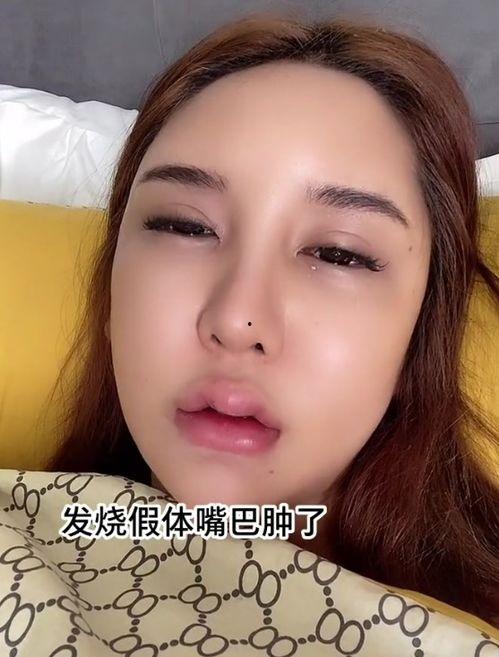 网红  整容  脸,揭秘流行趋势背后的真相